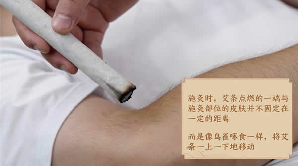 灸法种类：雀啄灸